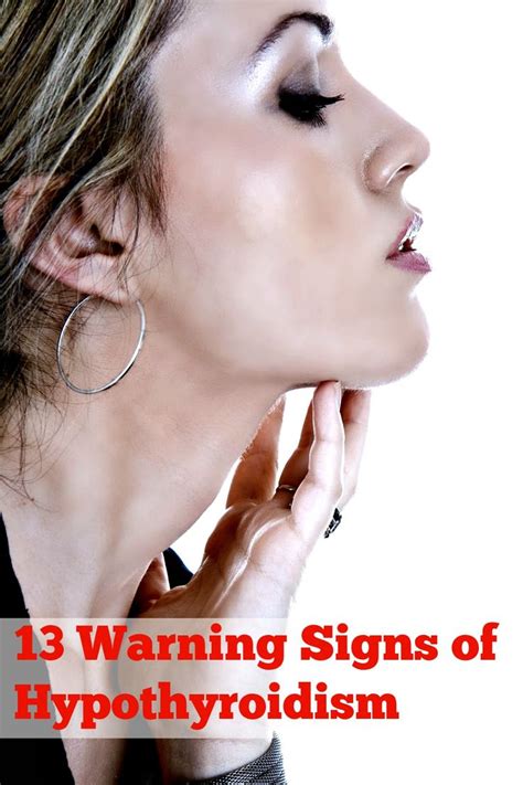 13 Warning Signs Of Hypothyroidism Natural Cures For Hypothyroidism