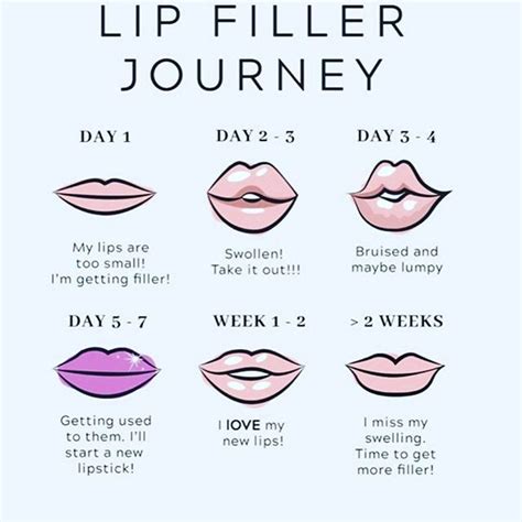 Lip Filler Journey And What To Expect • La Longevity