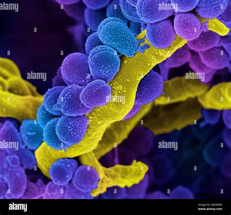 Las Bacterias Estreptococos Orales Color Análisis Micrografía De
