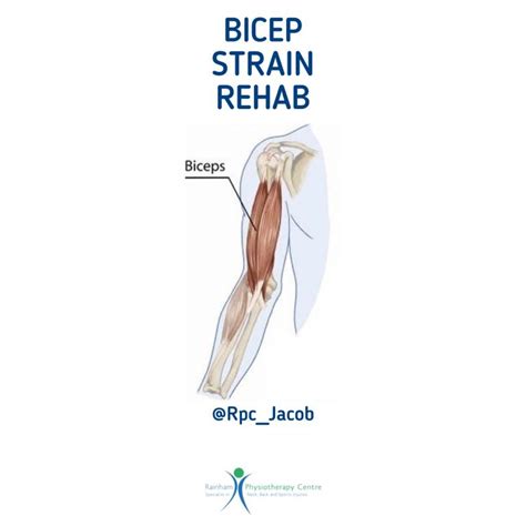 Bicep Strain Rehabilitation Rainham Physio