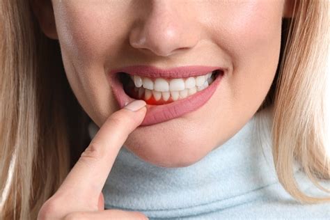 Common Signs Of Gum Disease Ismile Dental Team Pc Philadelphia
