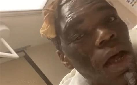 Video Rolling Ray Hospitalized After His Wig Catches Fire Aazios