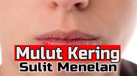 Tips Mengatasi Mulut Kering Youtube