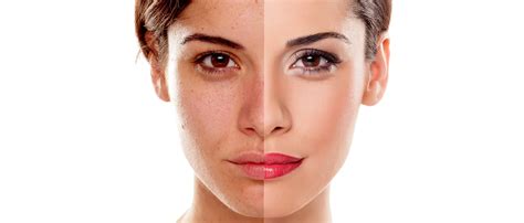 Reasons For Dull Skin And Ways To Restore Natural Skin Glow