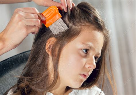 Lice Causes Symptoms Home Remedies And Prevention Tips Myhealthopedia
