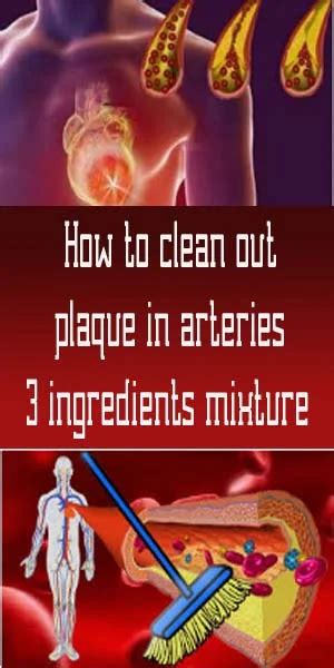 how to clean out plaque in arteries 3 ingredients mixture healthy lifestyle