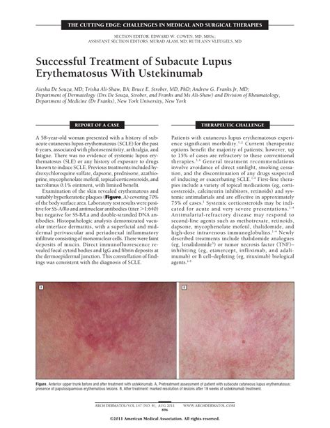 Successful Treatment Of Subacute Lupus Erythematosus With Ustekinumab Dermatology Jama