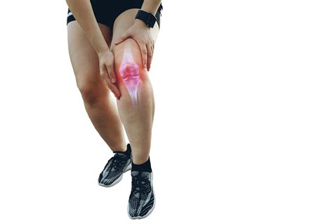 Cuál es el rol del ejercicio en la artrosis de rodilla Las protege o