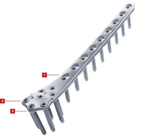 Distal Lateral Femur Locking Plate • 7s Medical International Ag