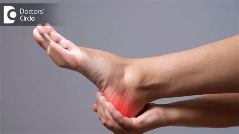 Causes Of Morning Heel Pain And Its Management Dr Hanume Gowda Youtube