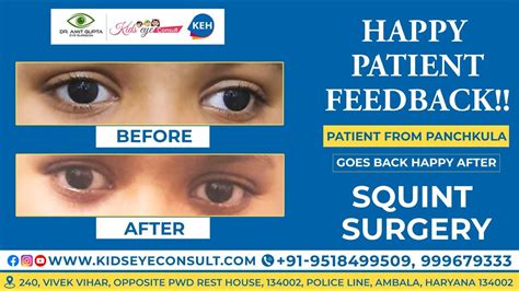 patient from panchkula goes back happy after squint surgery best squint doctor youtube