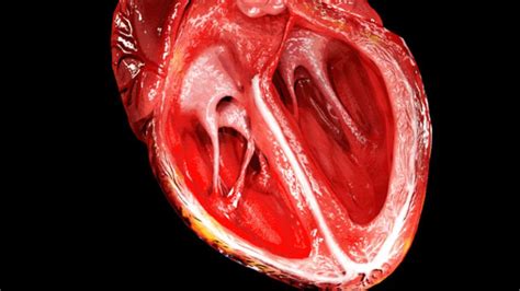 Real heart beating 44308 gifs. Scientists Use Stem Cells to Regenerate Layers of a Human Heart | Mental Floss