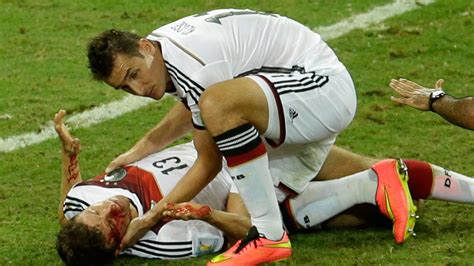 11 098 408 tykkäystä · 658 959 puhuu tästä. Germany's Muller all bloody after collision with Ghana ...