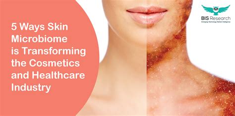 5 Ways Skin Microbiome Is Transforming The Cosmetics And Healthcare