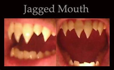 Jagged Mouth Fangs Please Read Item Description Etsy In 2022 Dental