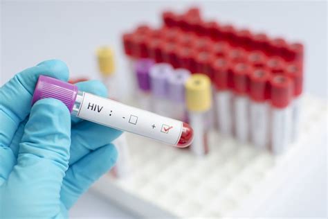 Four Common Misperceptions About Hiv Phillyvoice
