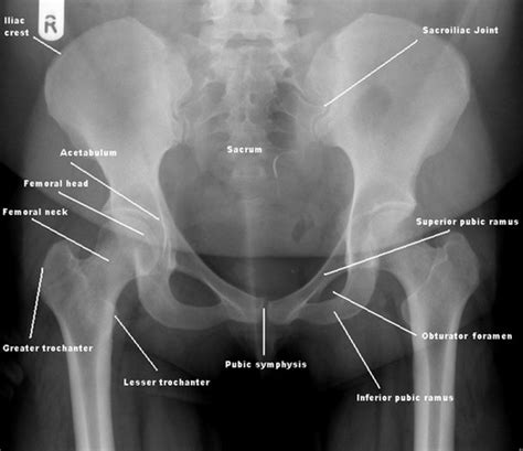 Emergency Radiography The Bmj