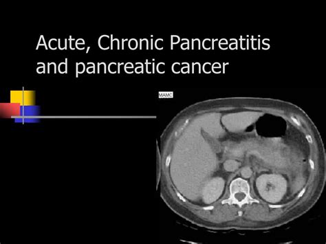 Ppt Acute Chronic Pancreatitis And Pancreatic Cancer Powerpoint