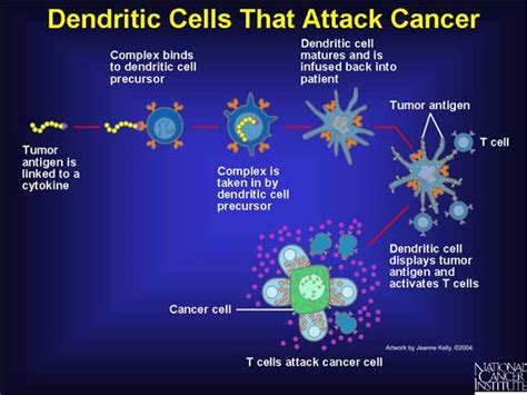 Systemic rna delivery to dendritic cells exploits antiviral defence for cancer immunotherapy. Dendritic Cell Immunotherapy, Cancer Dendritic Cell ...