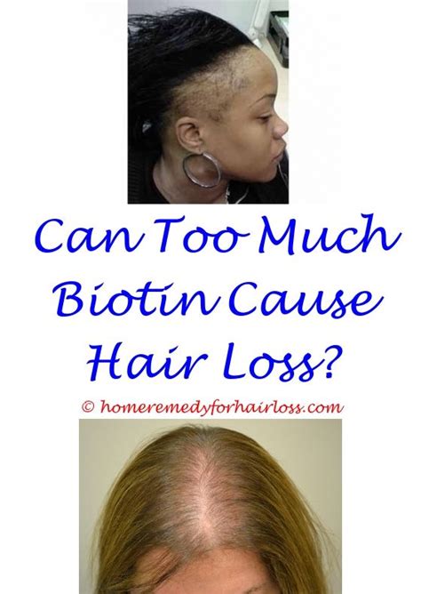 The feedback i'm getting from you gives us compelling new data for our research. Hair Implants For Men | Help hair loss, Treat hair loss ...