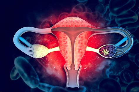 Fibromas uterinos causas síntomas y tratamiento