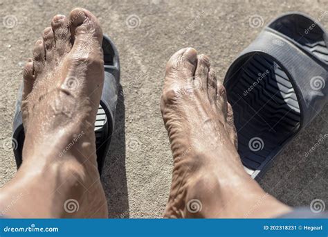 Elderly Working Man Feet After A Hard Day Stock Image Image Of Feet