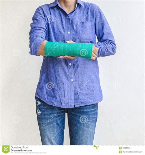 Woman Injured On Arm With Green Cast Stock Photo - Image of medicine, injured: 103021264