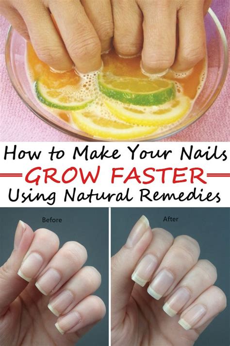 Remedy That Makes Your Nails Grow Faster In Just 8 Days Grow Nails