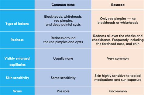 Rosacea Best Treatments According To Dermatologists Mdacne