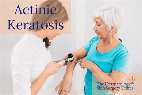 Dermatologists Answers To Common Questions About Actinic Keratosis