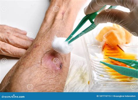 Wound Dressing Royalty Free Stock Photography 38361815