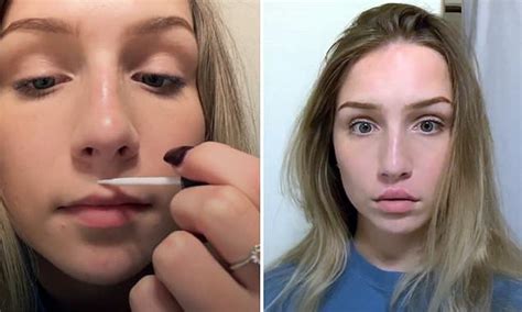 Bizarre Trend Where Women Glue Their Skin To Their Top Lip To Create A