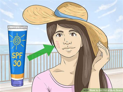 Although there are many over the counter creams which help in the fading away of the scars, yet they are not fruitful in completely eliminating them. 3 Ways to Get Rid of Burn Scars - wikiHow