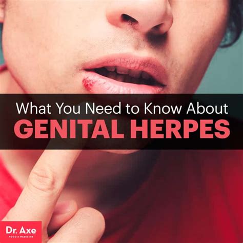 Lip Herpes Treatment Natural Wallpaperall