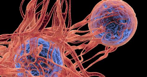 The time will come for them to decide on a new career, but they need to do this by choosing the projects that can help them professionally grow and feel stable. We Can Now Customize Cancer Cures, Tumor by Tumor - MIT ...