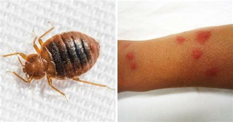 Most Common Bug Bites