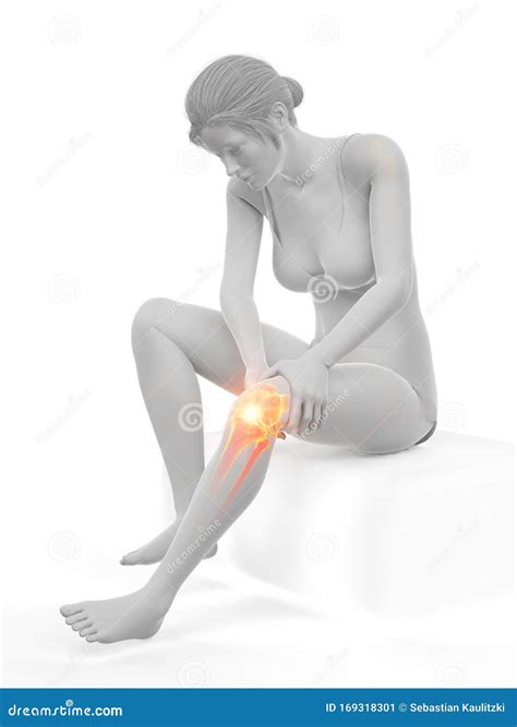 A Woman Having A Painful Knee Stock Illustration Illustration Of