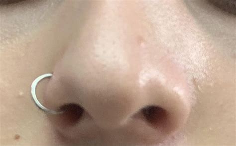 i got my nose pierced two months ago i got this bump does anybody knows what is that