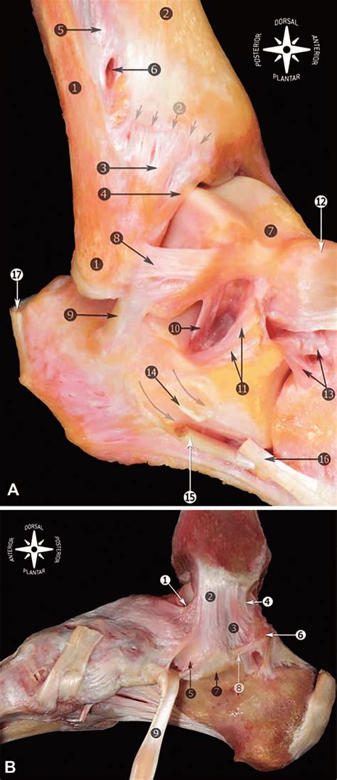 Anatomy of the ankle ligaments. Right ankle. A, Fibula and tip of the