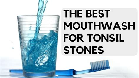 Bleeding Tonsils What To Do If Your Tonsils Bleed While Removing