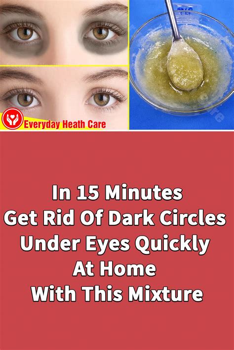 In 15 Minutes Get Rid Of Dark Circles Under Eyes Quickly At Home With