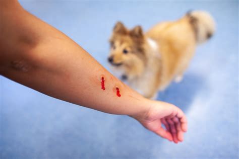 Why A Dog Bite Can Be More Costly Than You Think Middlesex County