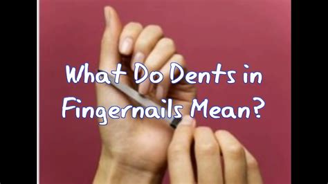 What Do Dents In Fingernails Mean Youtube