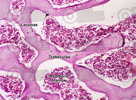 Mammal Spongy Osseous Tissue Femur Transverse Section 125x Spongy