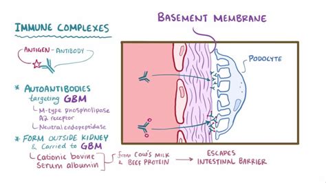 Membranous Nephropathy Genitourinary Disorders Msd Manual