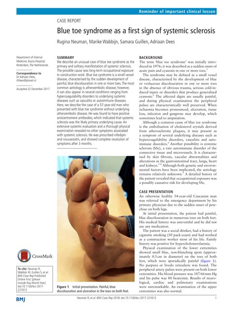 Pdf Blue Toe Syndrome As A First Sign Of Systemic Sclerosis