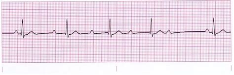 Most bachelor's degrees will require the completion of roughly 120 credits, which typically requires between four and six years for the. 301 Moved Permanently