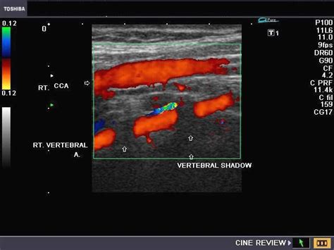A Gallery Of High Resolution Ultrasound Color Doppler 3D Images