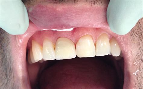 Restorative Dentistry - Seef DentalSeef Dental
