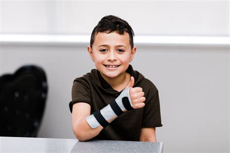 Forearm Based Splint Broken Arm Sprain Children